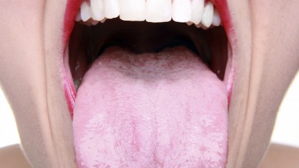 brush-your-tongue-436x245