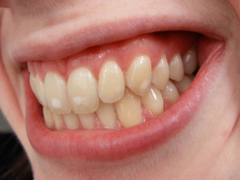 We're here to keep you smiling — no matter how your mouth is shaped! 