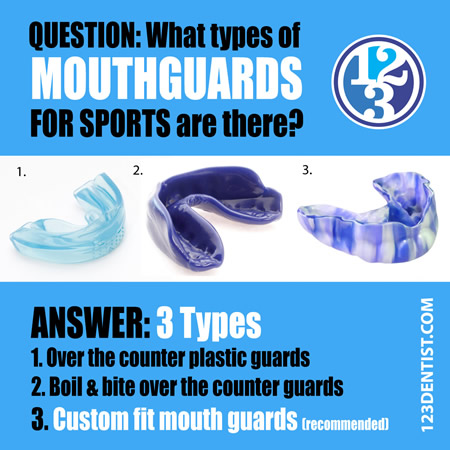 What types of mouthguards are there?