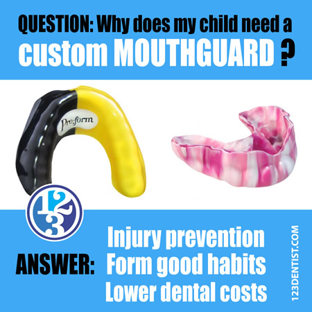 Does my child need a custom mouthguard?
