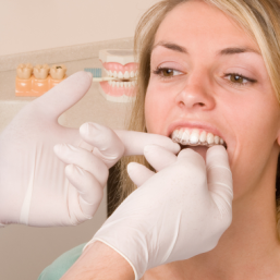 invisalign aligner fitting dentist