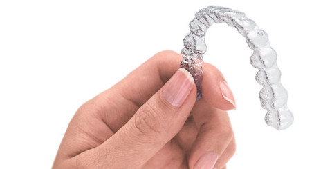 A typical Invisalign aligner tray.