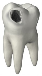 Tooth Decay is our enemy