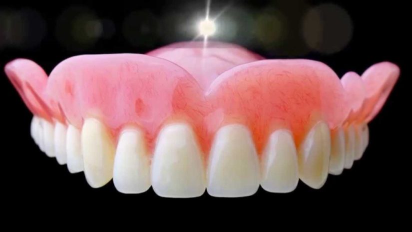 7 Easy Facts About Denture Explained