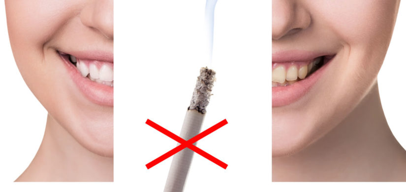 Why is smoking bad for your oral health?