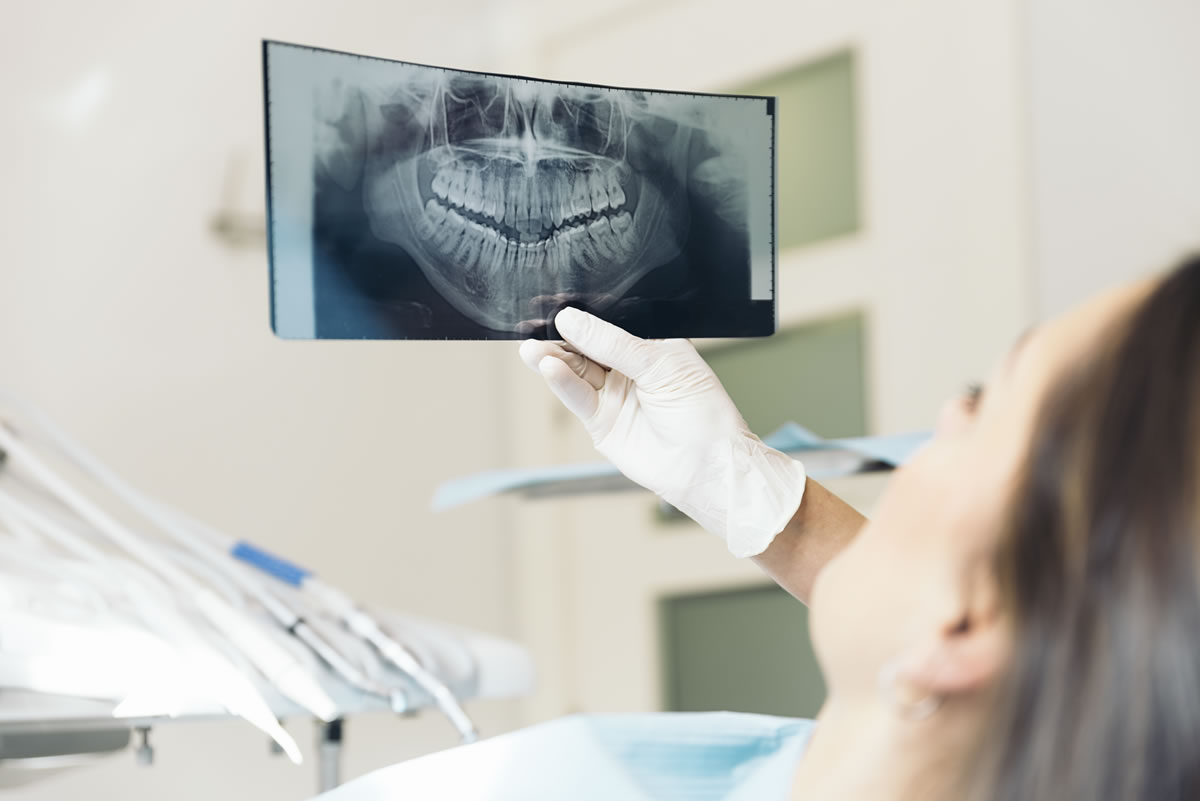 Digital X-rays emit approximately 80% less radiation than film X-rays.