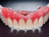 Dentures are a fact of life for many people