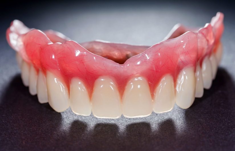 What is denture adhesive and do I need it? - from 123Dentist