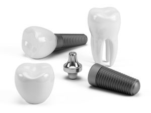 Dental Implant Components