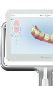 Orthodontists can also create better Invisalign treatment plans for their patients using iTero intraoral scans.