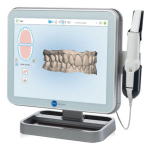 The iTero scanner is an example of 3D Digital Smile Design scanners