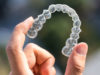 Living With Invisalign - What to Expect