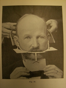 History-of-Orthodontics_small