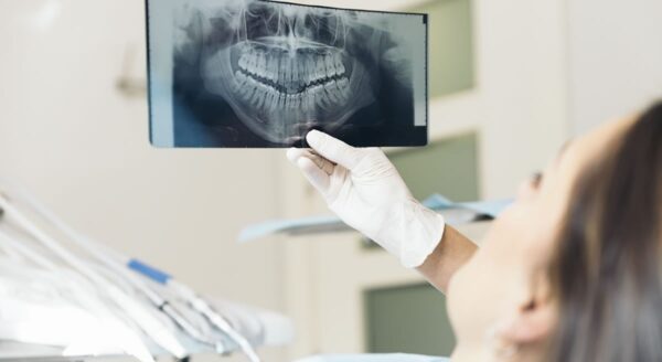 Digital X-rays emit approximately 80% less radiation than film X-rays.