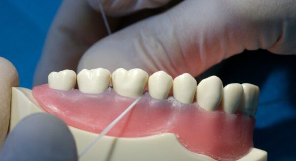 Gingivitis: What Is It & How To Deal With It