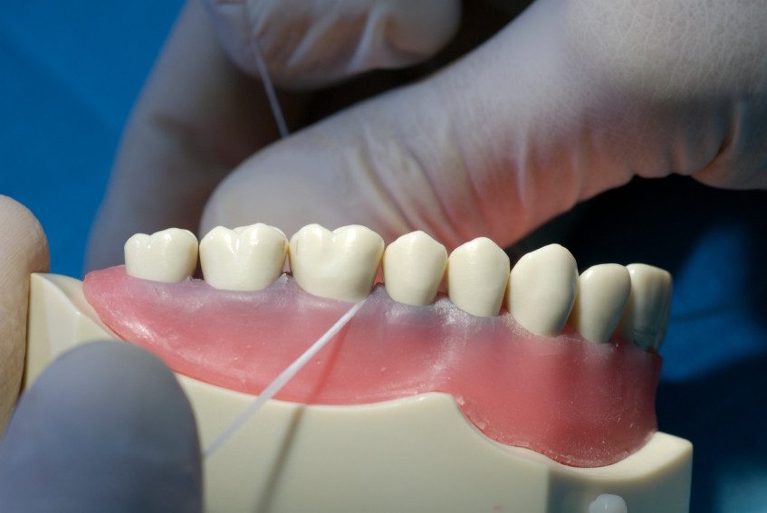 Gingivitis: What Is It & How To Deal With It