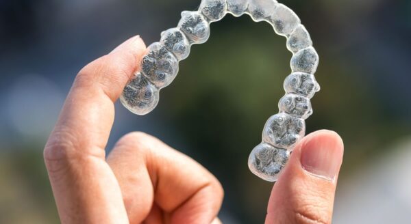 Living With Invisalign - What to Expect